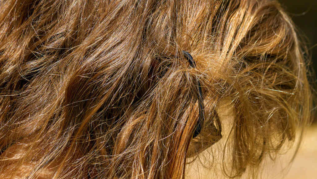 Trichonodose richtig und rechtzeitig behandeln