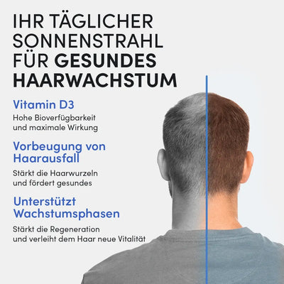 Ein Mann mit Halbglatze - daneben: Dr. Balwi Shop Vitamin D 1000 IE für gesundes Haarwachstum. Jetzt Vitamin D Tropfen gegen Haarausfall und Vitamin-D-Mangel entdecken!.