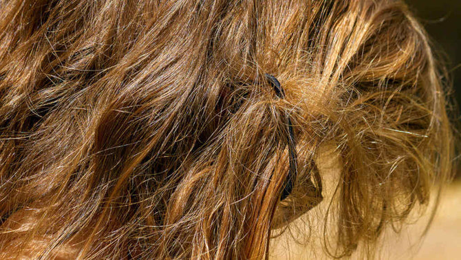 Trichonodose richtig und rechtzeitig behandeln