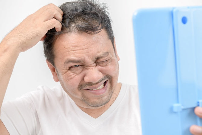 Hängen Seborrhoische Dermatitis und Haarausfall zusammen?