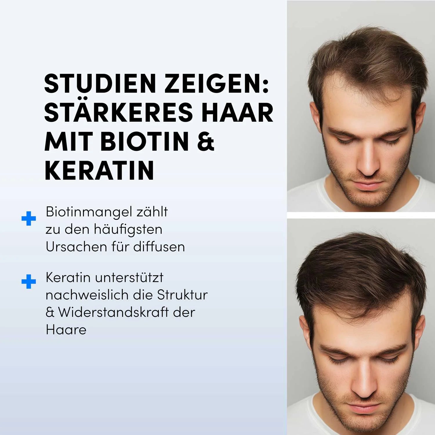 Zwei Bilder zeigen einen jungen Mann mit dünner werdendem und vollerem Haar; der deutsche Text erklärt, dass Biotin- und Keratintabletten von shop.elithairtransplant das Haarwachstum unterstützen und Studien zufolge zahlreiche Vorteile für die Haargesundheit bieten.