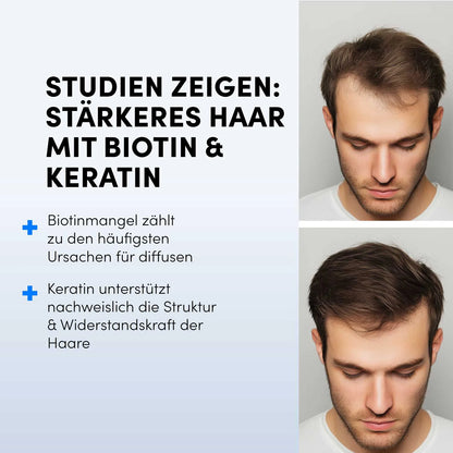Zwei Bilder zeigen einen jungen Mann mit dünner werdendem und vollerem Haar; der deutsche Text erklärt, dass Biotin- und Keratintabletten von shop.elithairtransplant das Haarwachstum unterstützen und Studien zufolge zahlreiche Vorteile für die Haargesundheit bieten.