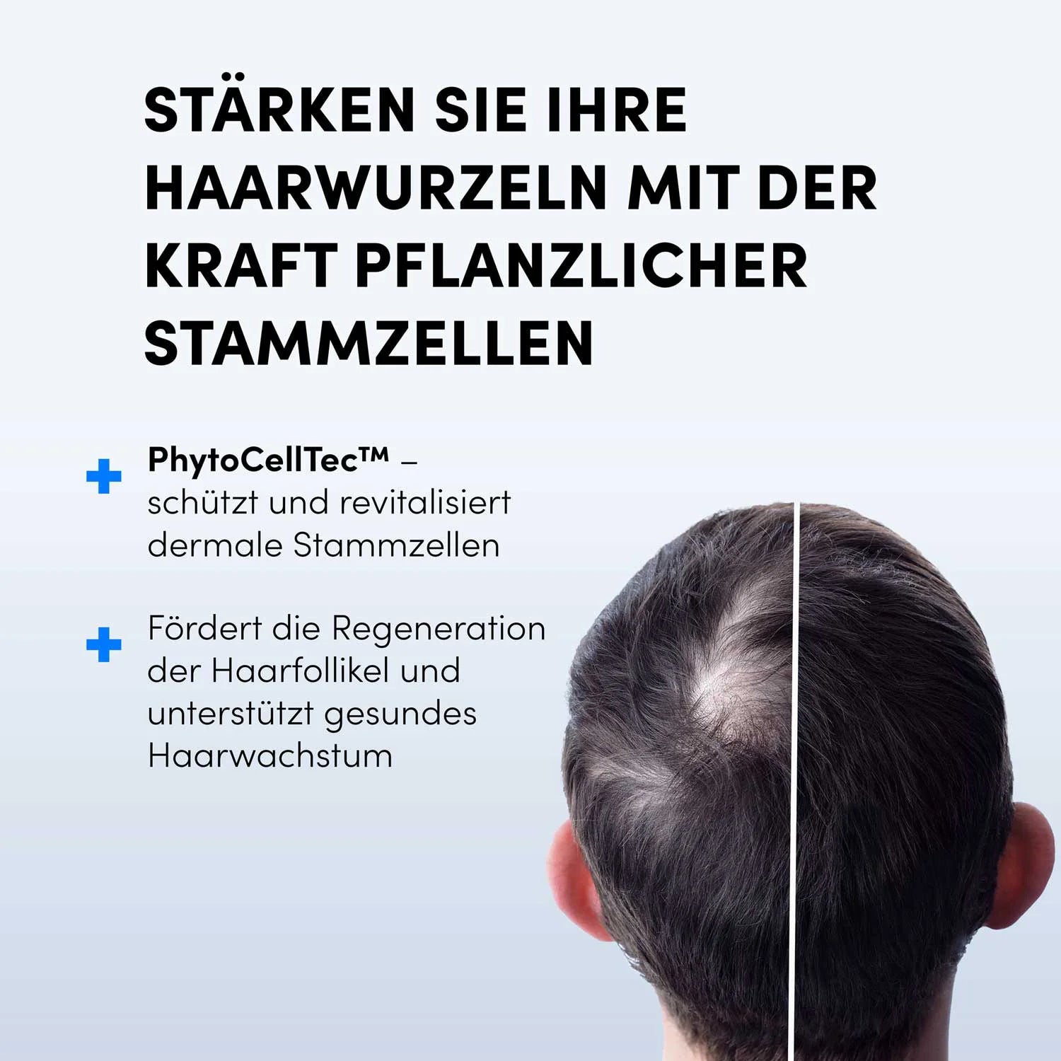 Eine Person mit schütterem Haar von hinten. Deutscher Text wirbt für das Dr. Balwi Hair Boost Set von shop.elithairtransplant mit PhytoCellTec™ und AnaGain™ zur Stärkung der Haarwurzeln, zum Schutz der Haarfollikel und zur Unterstützung eines gesunden Haarwachstums mithilfe pflanzlicher Stammzellen.