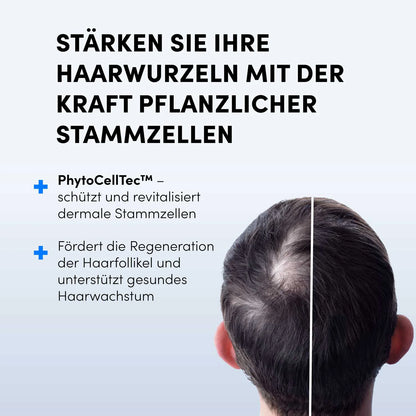 Eine Person mit schütterem Haar von hinten. Deutscher Text wirbt für das Dr. Balwi Hair Boost Set von shop.elithairtransplant mit PhytoCellTec™ und AnaGain™ zur Stärkung der Haarwurzeln, zum Schutz der Haarfollikel und zur Unterstützung eines gesunden Haarwachstums mithilfe pflanzlicher Stammzellen.