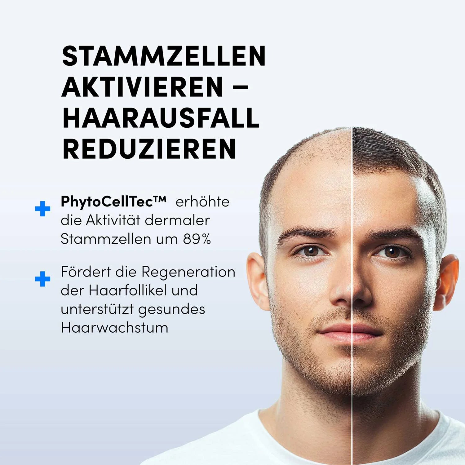 Das Gesicht eines jungen Mannes ist in zwei Hälften geteilt – links schütteres Haar, rechts volles Haar. Im Text wird das Dr. Balwi Hair Boost Set von shop.elithairtransplant mit PhytoCellTec™ und Procapil™ zur Förderung gesunden Haarwachstums vorgestellt.