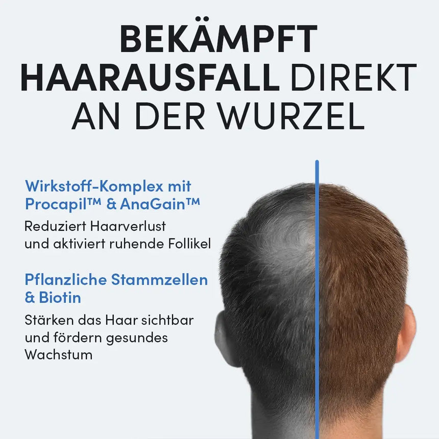 Der Kopf eines Mannes, links mit Glatze, rechts mit dichtem Haar. Der deutsche Text erklärt, wie die Dr. Balwi Meso Therapie (Nachfüllpackung) aus dem Dr. Balwi Shop mit pflanzlichen Stammzellen Haarausfall verhindern und das Wachstum anregen kann.