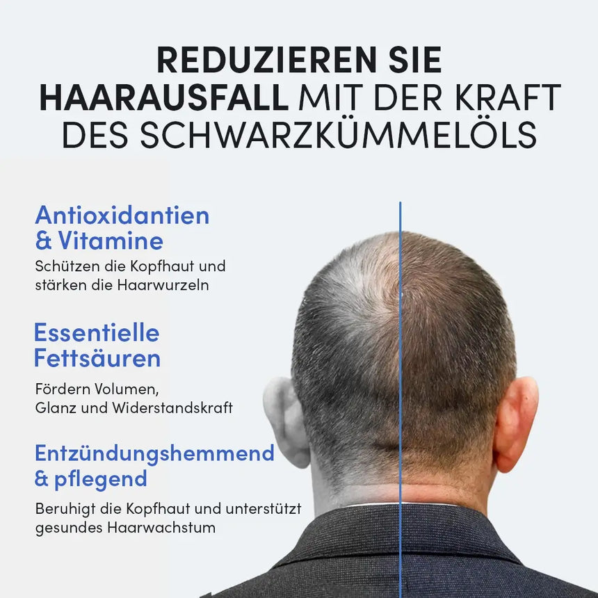 Ein Mann mit lichtem Haar von hinten, daneben Text zu Premium Schwarzkümmelöl von Dr. Balwi Shop: Schützt die Kopfhaut, beugt Haarausfall vor und verleiht mehr Volumen dank pflegender Fettsäuren und Antioxidantien.