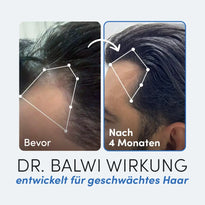 Vorher-nachher Vergleich eines Mannes nach 4 Monaten mit Bromelain von Dr. Balwi Shop: links weniger Haare, rechts sichtbar vollere Haarlinie. Text ist auf Deutsch.