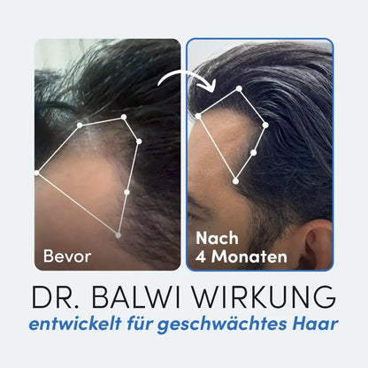 Vorher-nachher Vergleich eines Mannes nach 4 Monaten mit Bromelain von Dr. Balwi Shop: links weniger Haare, rechts sichtbar vollere Haarlinie. Text ist auf Deutsch.