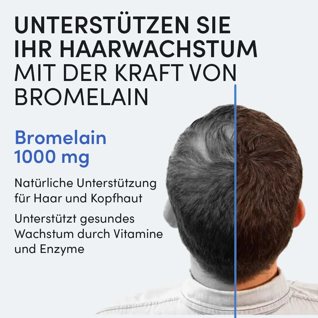 Ein Mann mit kurzem braunem Haar ist von hinten zu sehen. Text wirbt für Dr. Balwi Shop Bromelain-Kapseln mit Ananas-Extrakt zur natürlichen Unterstützung bei Haarausfall und zur Förderung des Haarwachstums dank Vitaminen und Enzymen.