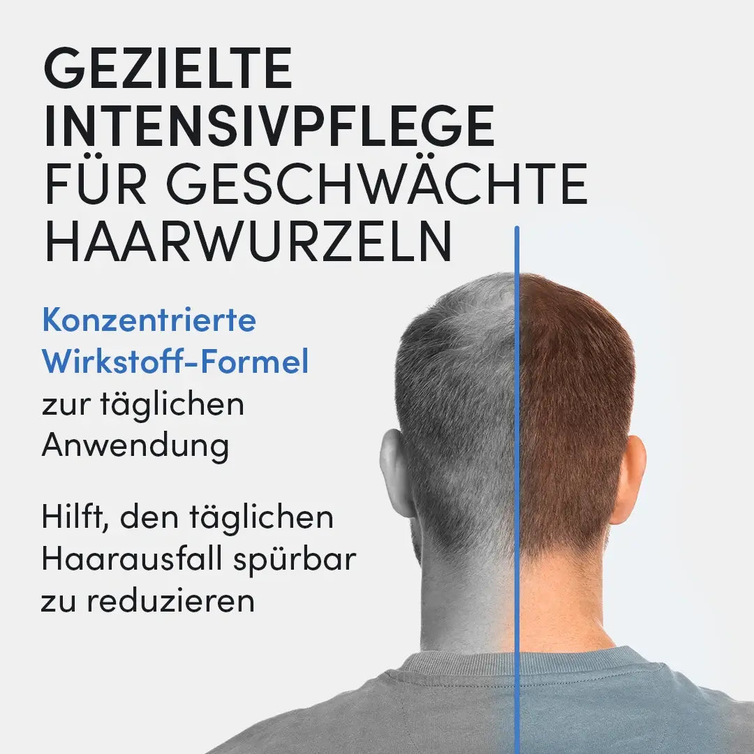 Ein Mann mit kurzem Haar von hinten. Daneben steht: "Dr. Balwi Hair Serum von Dr. Balwi Shop - Intensivpflege für geschwächte Haarwurzeln mit Aloe Vera. Tägliche Anwendung hilft, Haarverlust spürbar zu reduzieren.