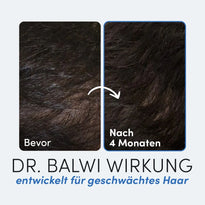 Der nebeneinander liegende Vergleich der Kopfhaut, beschriftet mit Vorher und Nach 4 Monaten, zeigt ein sichtbar dichteres Haarwachstum nach der Anwendung von Daily Omega 3 by Dr. Balwi Shop, entwickelt zur Unterstützung von geschwächtem Haar.