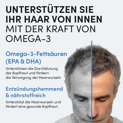 Ein Mann mittleren Alters mit schütterem Haar blickt nach unten, neben einem deutschen Text, der erklärt, wie Dr. Balwi Shop's Daily Omega 3 das Haarwachstum unterstützt, den Haarausfall reduziert, die Durchblutung der Kopfhaut verbessert, Entzündungen bekämpft und das Haar pflegt.