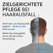Von hinten: Mann mit schütterem Haar. Links Text: "Gezielte Haarausfall-Pflege mit Dr. Balwi Shampoo von Dr. Balwi Shop - fördert gesundes Haarwachstum direkt an der Wurzel und stärkt das Haar schon ab der ersten Anwendung.