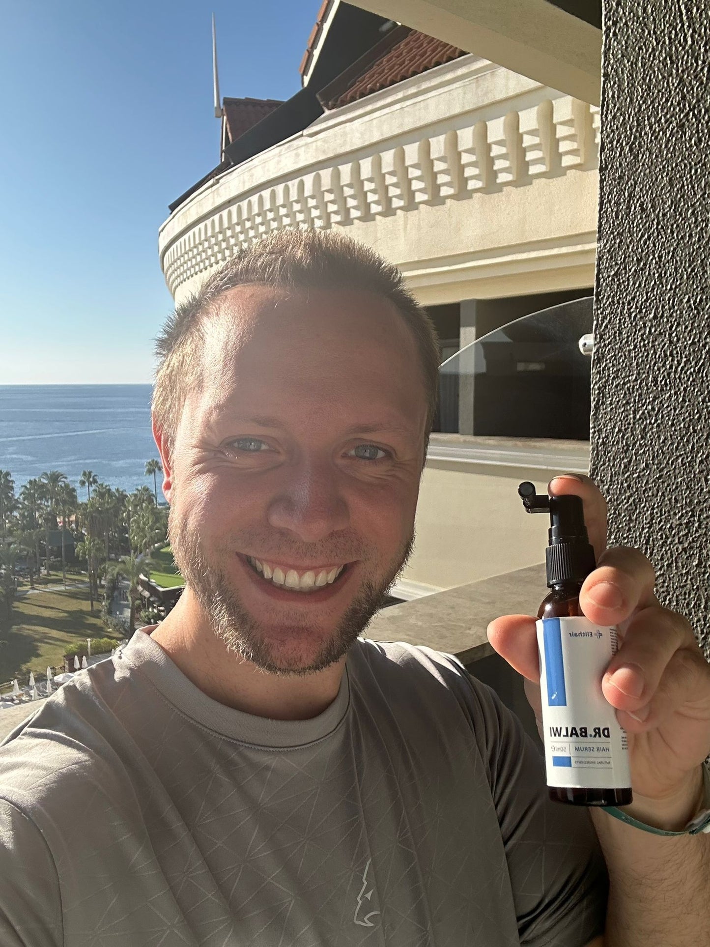 Ein lächelnder Mann steht auf einem sonnigen Balkon mit Blick auf das Meer und hält das Dr. Balwi Hair Serum von shop.elithairtransplant mit einer Sprühdüse hoch – und präsentiert inmitten von Palmen und verzierten Geländern seine hochkonzentrierte Formel für Haarwachstum.