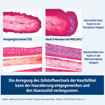 Mikroskopische Aufnahmen, die Haarfollikel vor und nach viermonatiger Anwendung des Dr. Balwi-Shampoos vergleichen und zeigen, wie die Anregung des Zellstoffwechsels durch Procapil die Alterung der Haare und den Haarausfall verlangsamen kann.